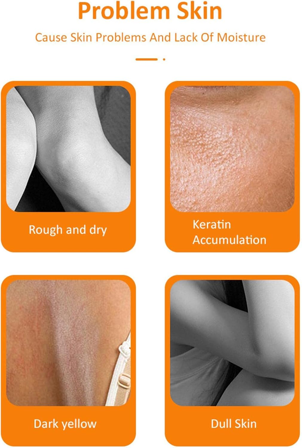 PIGMANA 100ml Orange Peel Off Lotion,100ml Brightening Peeling Gel Exfoliate Essence - Effective Dead Skin Remover Pedicure for All Skin Types